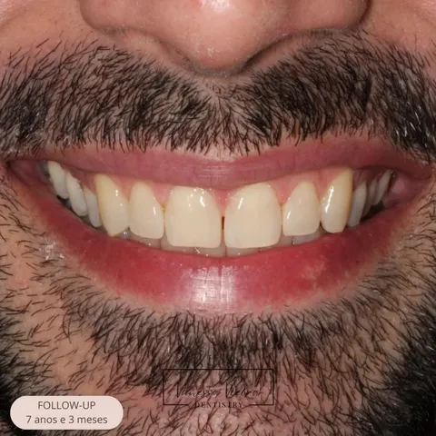 O sorriso do caso de 2017, fotografado 7 anos e 3 meses depois, com o selo de follow-up